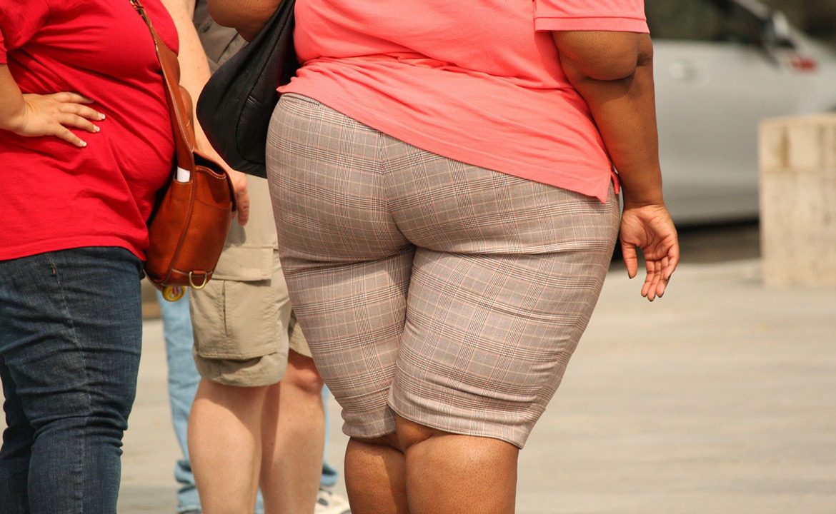 otyłość, cukrzyca, jak schudnąć, otyłość pierwotna, otyłość wtórna