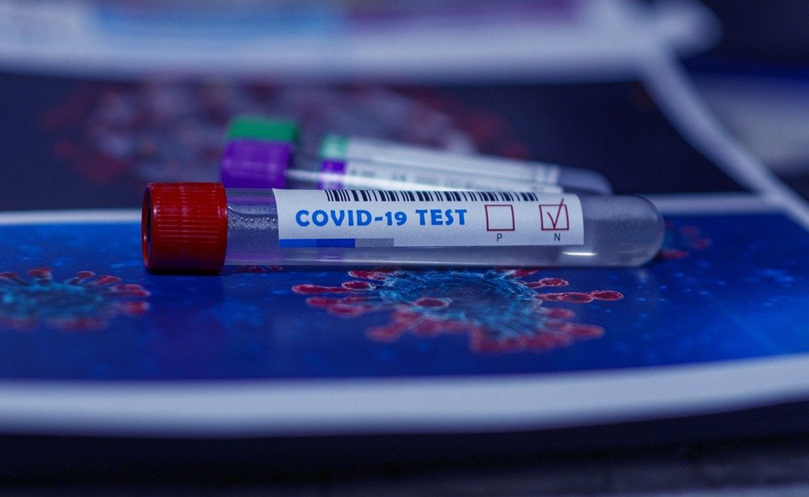 covid-19, rtest na covid, test serologiczny, epidemia, koronawirus, testowanie